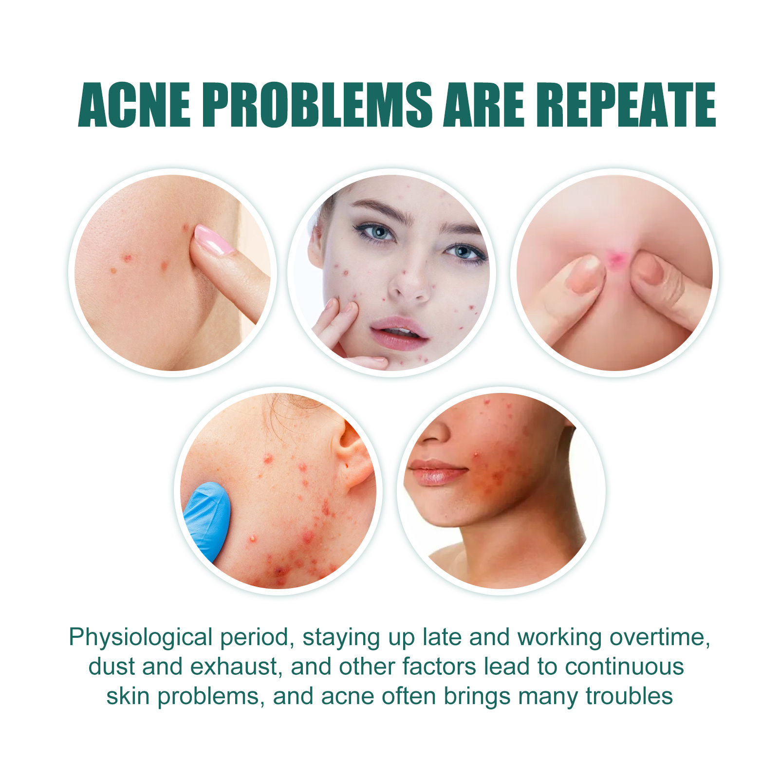Skincare Gentle - Star-Shaped Acne Pimple Patch - Gentle