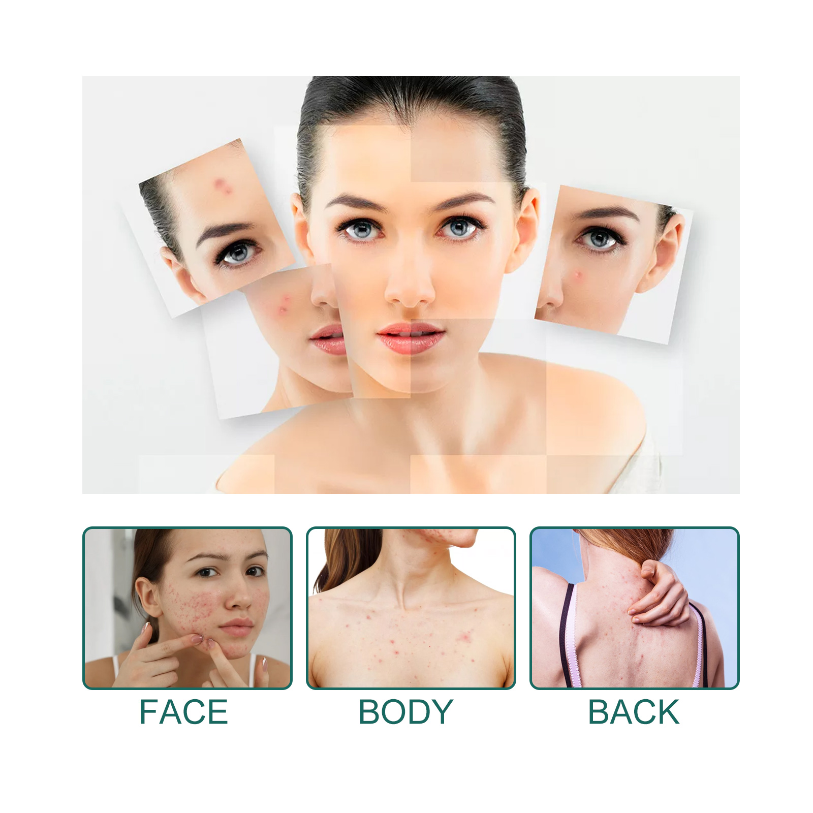 Star-Shaped Acne Pimple Patch  - Skincare Gentle บทวิจารณ์และราคา