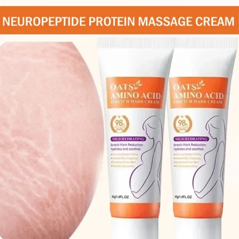 Stretch Marks Permanent Remova - Skincare Oat บทวิจารณ์และราคา